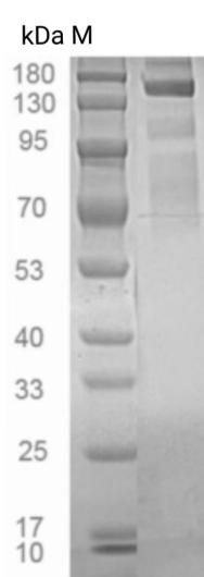 SDS-PAGE（十二烷基磺酸钠-聚丙烯酰胺凝胶电泳）图